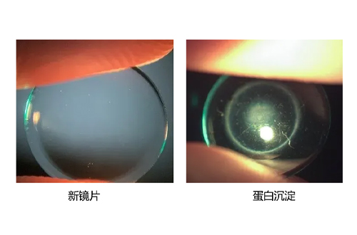 蛋白沉淀 蛋白沉淀